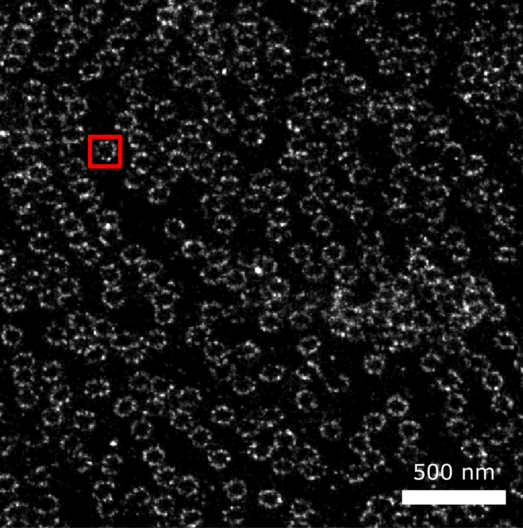 **Figure 4:** Test images for template matching assignment. Superresolution microscopy image showing NPCs of a human cell and a template.